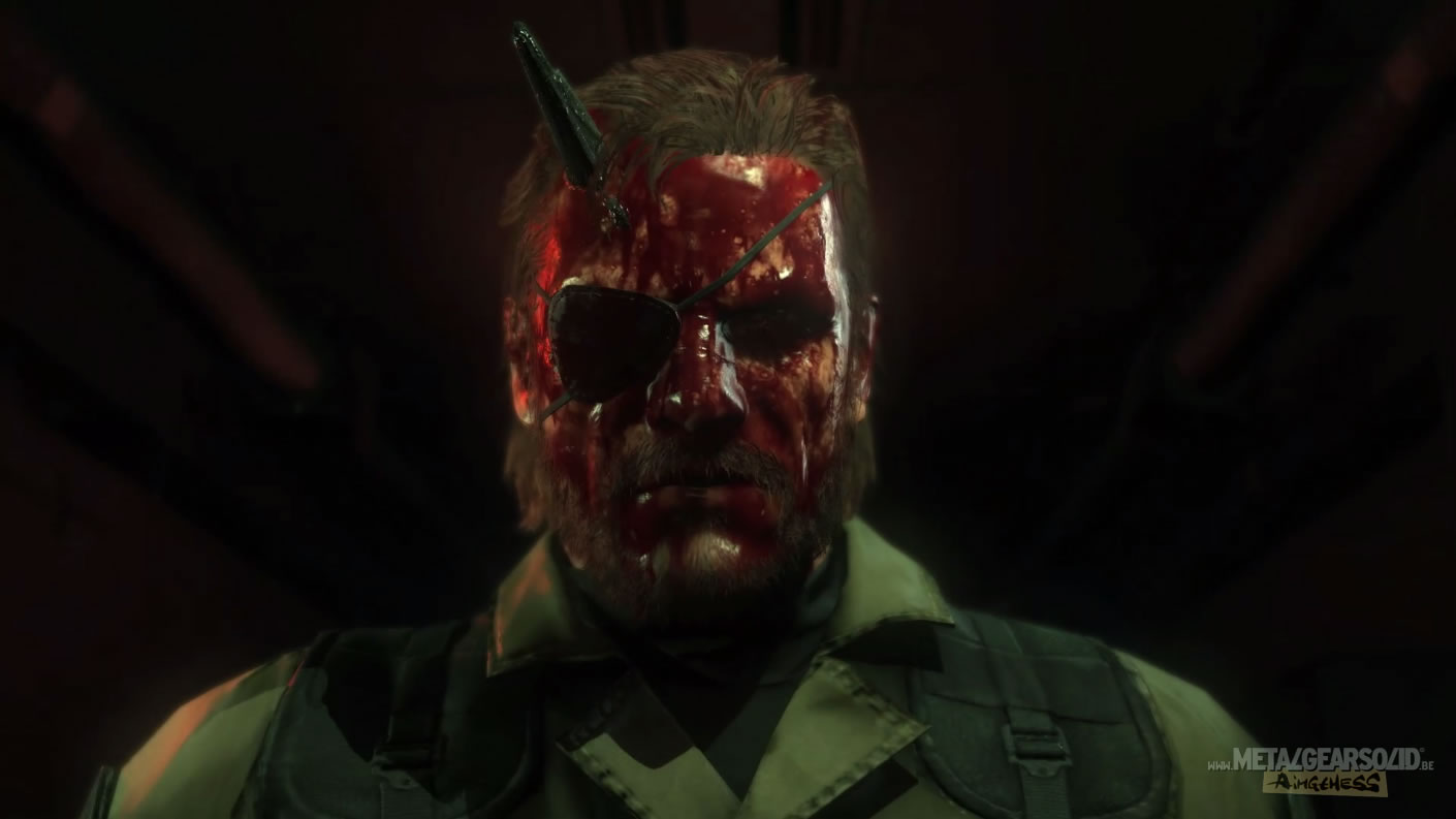 E3 2015 : Notre galerie d'images des trailers de Metal Gear Solid V : The Phantom Pain