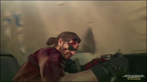 Gamescom 2015 : Notre galerie d'images du trailer de Metal Gear Solid V : The Phantom Pain