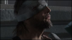 MGSV : Le bandage qui ne soulage pas les fans de leur impatience